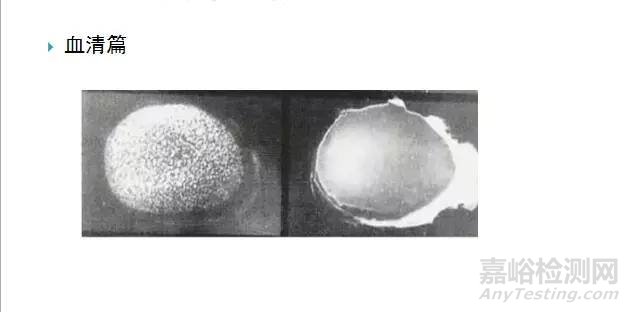 沙門氏菌檢測(cè)標(biāo)準(zhǔn)、方法及實(shí)驗(yàn)關(guān)鍵點(diǎn)