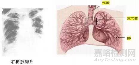 石棉的危害及檢測要求