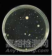 菌落總數(shù)測定新版國標GB 4789.2-2016檢測要點