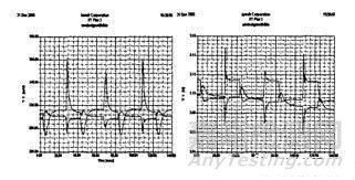 高速PCB中電源完整性的仿真與分析