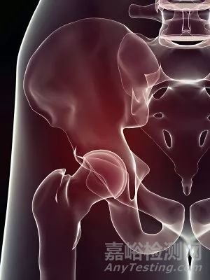 【醫(yī)療器械】骨科零件加工的新策略