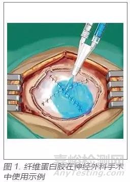 醫(yī)用密封膠的研究進展