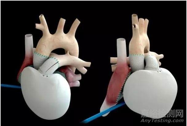 2018全球十大最具黑科技的醫(yī)械產(chǎn)品
