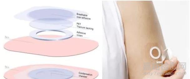 2018全球十大最具黑科技的醫(yī)械產(chǎn)品