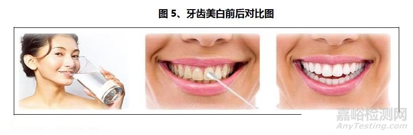 口腔醫(yī)療行業(yè)研究報(bào)告——器械篇