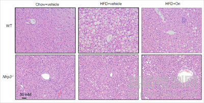 冬凌草甲素可抑制NLRP3炎癥小體且對2型糖尿病和痛風(fēng)等疾病有較好預(yù)防和治療效果