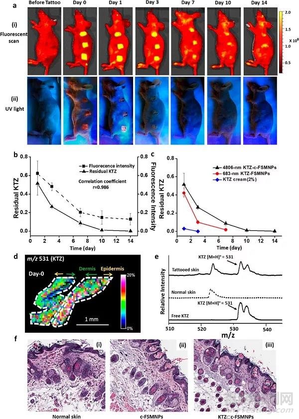 皮下注射具有熒光的交聯(lián)超分子納米顆粒控釋抗真菌藥物用于治療甲真菌病
