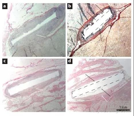 經(jīng)典綜述鑒賞:全面解讀塊體金屬玻璃