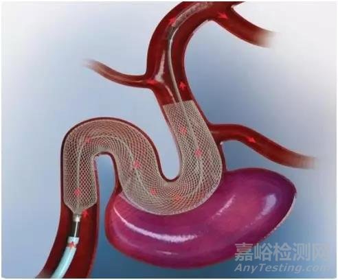 FDA又批準(zhǔn)一款治療動脈瘤的支架