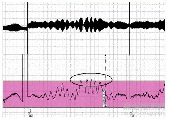 醫(yī)療植入物材料的無損檢測方法