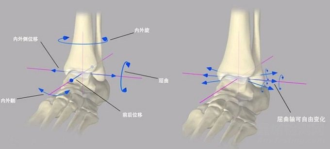 【醫(yī)療器械】人工踝關(guān)節(jié)假體設(shè)計(jì)