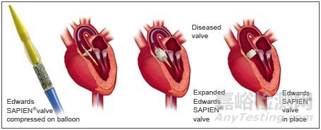 多層導(dǎo)管在醫(yī)療上的應(yīng)用