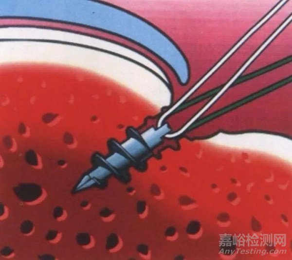 醫(yī)療器械產(chǎn)品注冊臨床階段部分問題探討