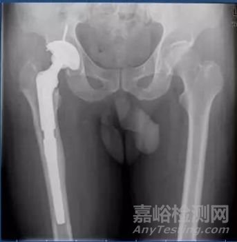 醫(yī)療器械產(chǎn)品注冊臨床階段部分問題探討