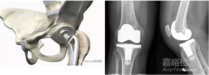 骨科植入物的微觀性能評價與失效分析