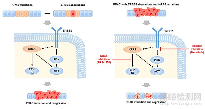 研究發(fā)現(xiàn)胰腺癌的新型治療靶點