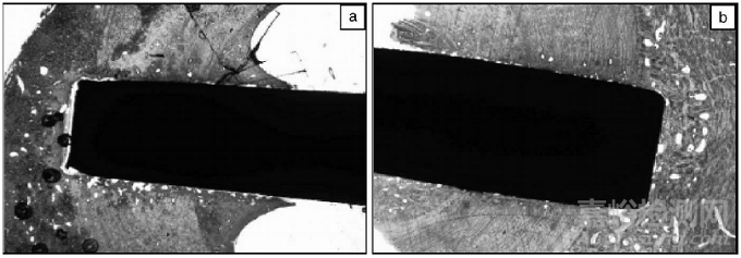 醫(yī)用不銹鋼與普通不銹鋼的差別