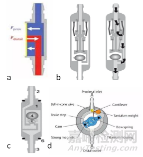 腦積水分流器產(chǎn)品技術簡介