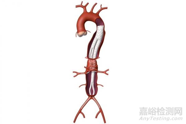 盤(pán)點(diǎn)2019年十大FDA突破性醫(yī)療器械