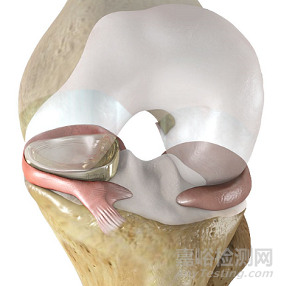 盤(pán)點(diǎn)2019年十大FDA突破性醫(yī)療器械