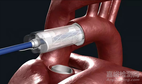 盤(pán)點(diǎn)2019年十大FDA突破性醫(yī)療器械