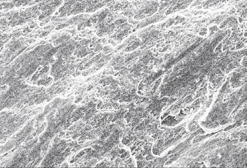 不銹鋼螺釘斷裂失效分析