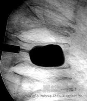 盤點骨科史上那些驚艷的明星產(chǎn)品