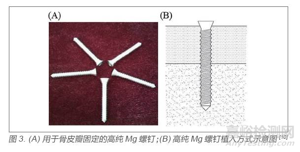 醫(yī)用金屬材料研發(fā)與應(yīng)用進(jìn)展