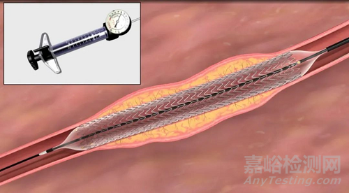 我國(guó)首個(gè)外周藥物洗脫支架獲批上市
