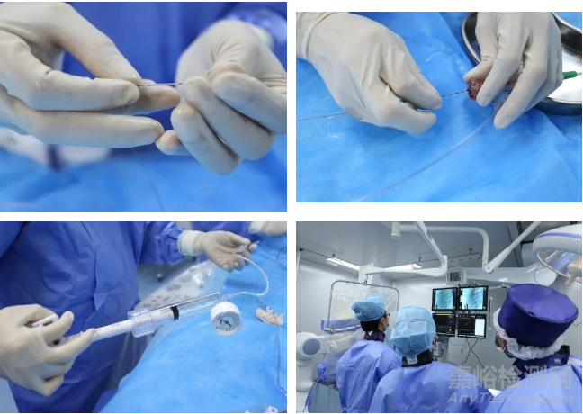 醫(yī)療器械原位植入實驗方法與實例詳解