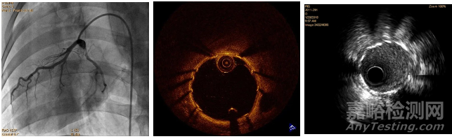 醫(yī)療器械原位植入實驗方法與實例詳解