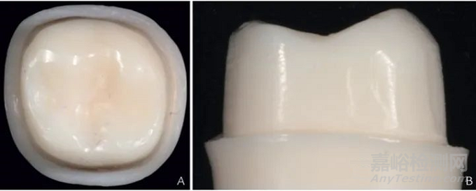 人造牙齒的材料選擇