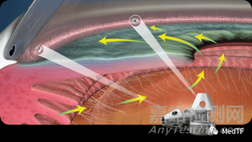 2020年最具創(chuàng)新性的18個(gè)醫(yī)療器械