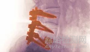 聚醚醚酮（PEEK）的定制在骨科及齒科等植入領(lǐng)域的應(yīng)用 