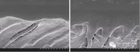 牙科粘結(jié)劑的粘接原理和主要質(zhì)量檢測項目