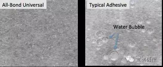 牙科粘結(jié)劑的粘接原理和主要質(zhì)量檢測項目