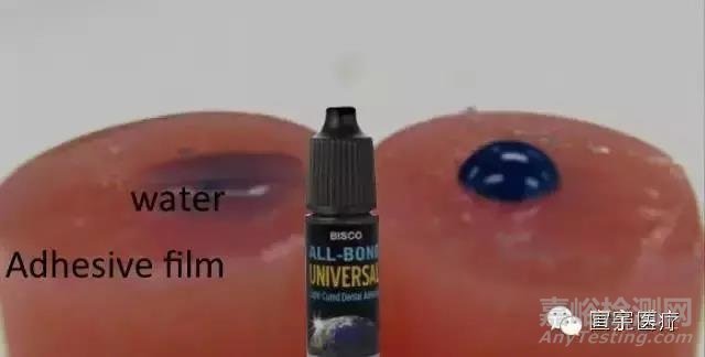 牙科粘結(jié)劑的粘接原理和主要質(zhì)量檢測項目
