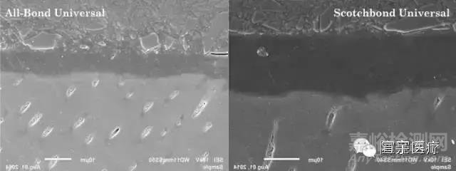 牙科粘結(jié)劑的粘接原理和主要質(zhì)量檢測項目