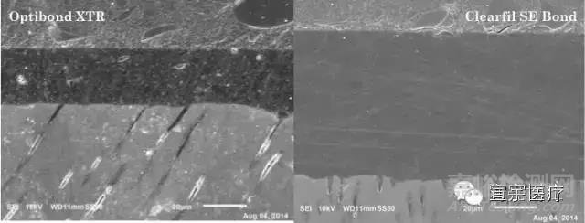 牙科粘結(jié)劑的粘接原理和主要質(zhì)量檢測項目