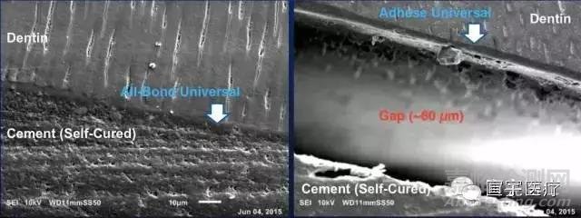 牙科粘結(jié)劑的粘接原理和主要質(zhì)量檢測項目