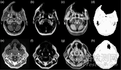 植入性器械需要多努力，才能與磁共振兼容？