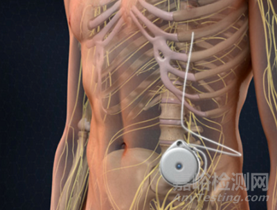 植入性器械需要多努力，才能與磁共振兼容？