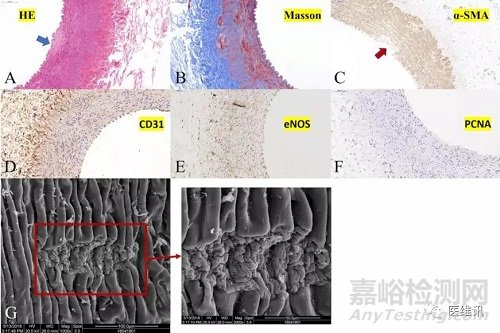 取栓支架產(chǎn)品獲批上市，與美敦力產(chǎn)品比較試驗