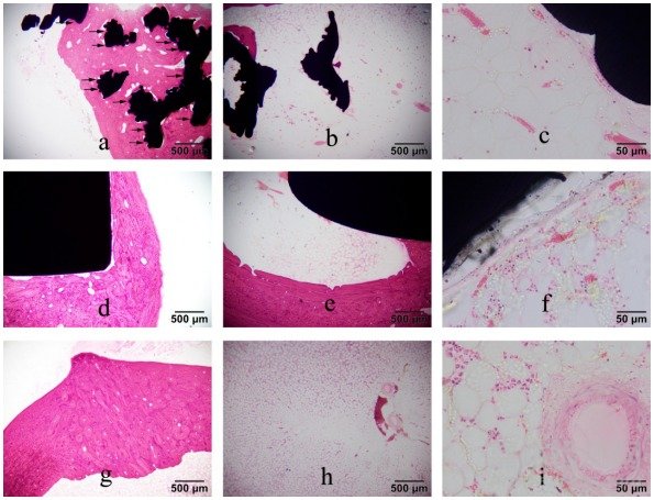 3D 打印骨小梁髖關(guān)節(jié)假體材料在體骨修復(fù)及離子析出中的應(yīng)用