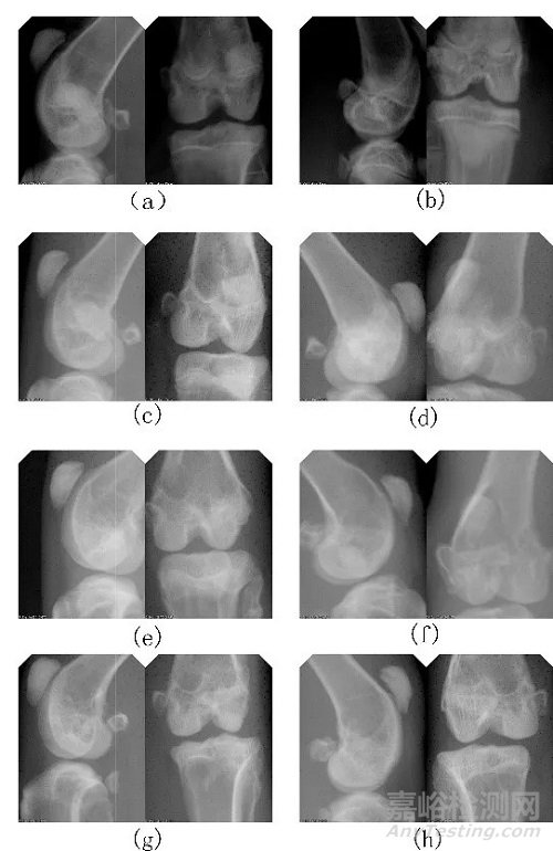 基于組織病理學(xué)及影像數(shù)據(jù)分析的人工骨植入實(shí)驗(yàn)評(píng)價(jià)研究