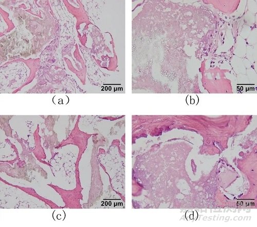 基于組織病理學(xué)及影像數(shù)據(jù)分析的人工骨植入實(shí)驗(yàn)評(píng)價(jià)研究