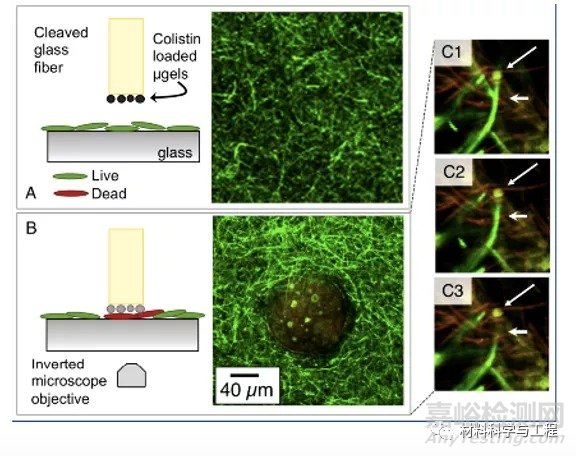 綜述：自防御抗菌生物材料表面
