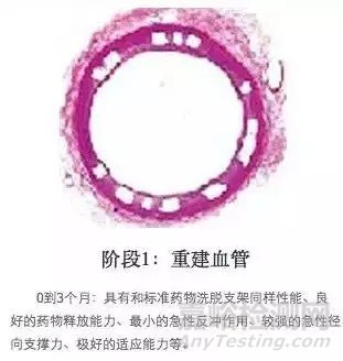 生物可降解支架的介紹及原理