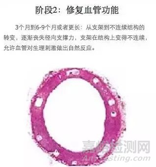 生物可降解支架的介紹及原理