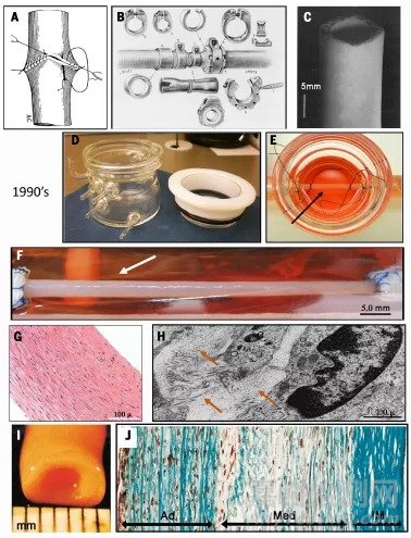 Science綜述：人造血管
